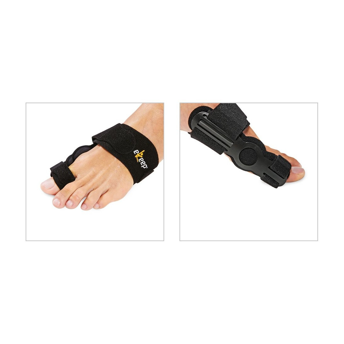 EKEEP H2 HALLUX VALGUS NOTT 01